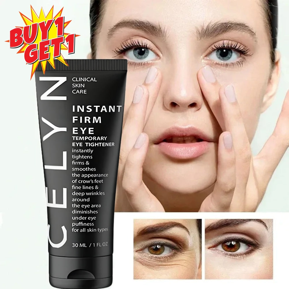 RadiantEye Perfecting Cream by Celyn | Buy 1 Get 1 FREE 🔥