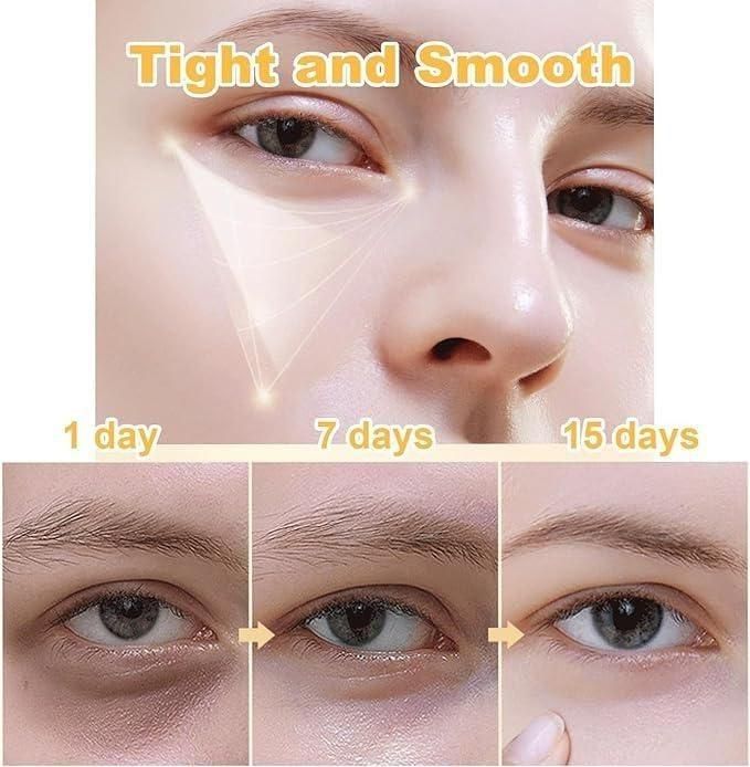 RadiantEye Perfecting Cream by Celyn | Buy 1 Get 1 FREE 🔥