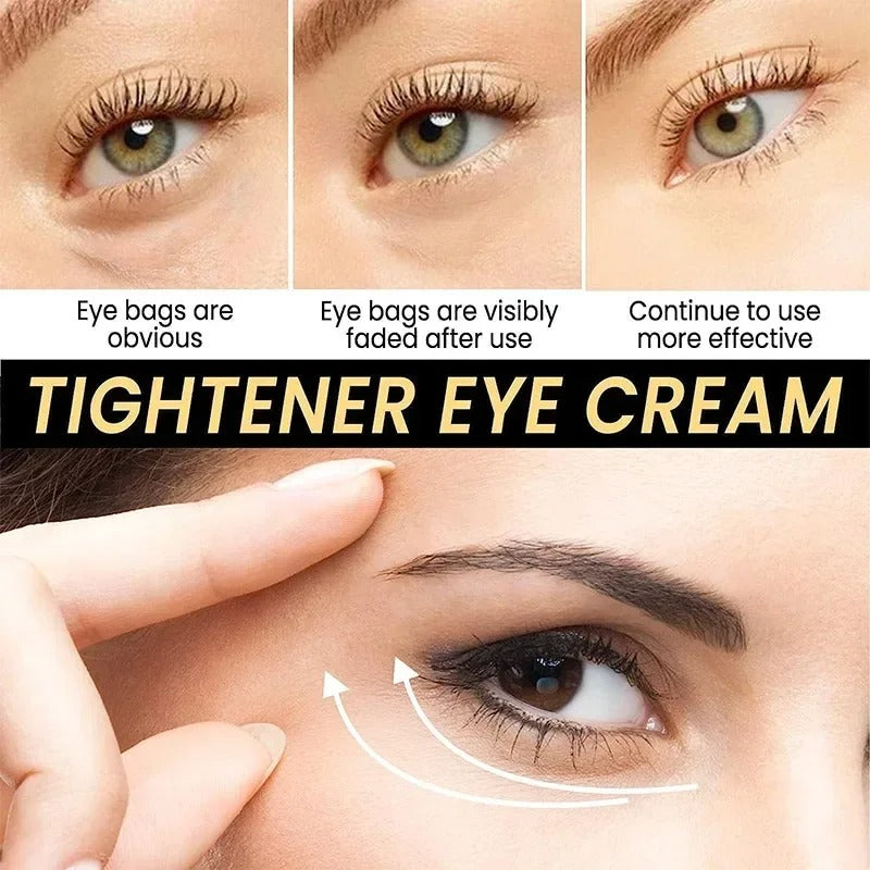 RadiantEye Perfecting Cream by Celyn | Buy 1 Get 1 FREE 🔥